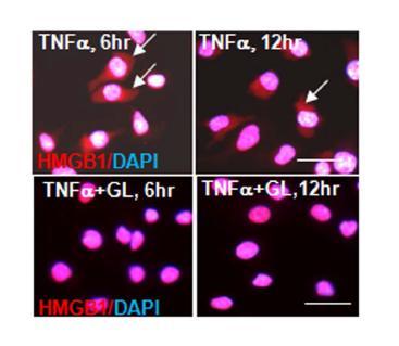 BV2 세포에 TNFa를 처리한 후 6 시간, 12 시간 후 HMGB1이 핵->세포질로 이동하는 것을 GA 가 억제하는 지를 면역형광 염색법으로 확인함.
