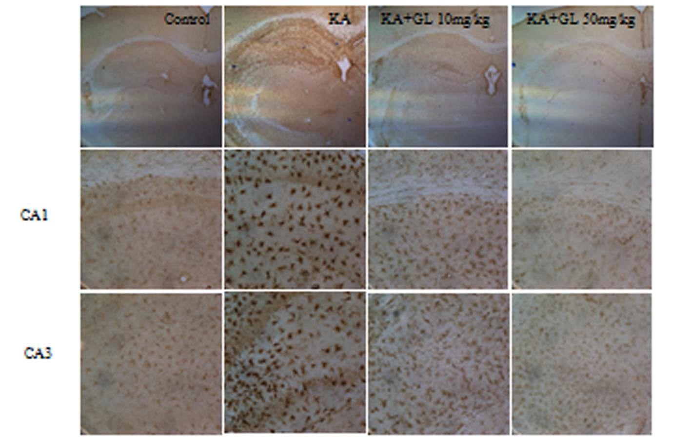 KA 투여 후, 4일 후에 Iba-I 항체를 사용해 면역조직화학 염색법을 수행하여, microglia 활성화를 조사. GA는 10 또는 50 mg/kg를 복강에 투여하였음.