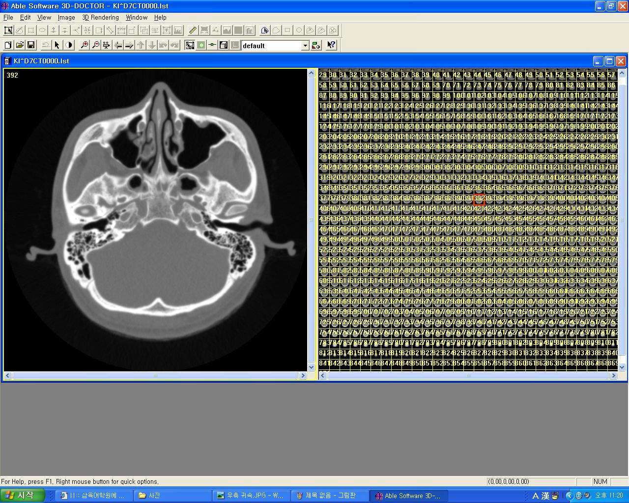 CT scam image of a male