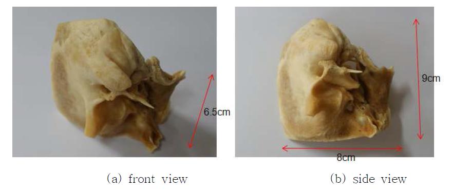 Temporal bone of a Korean male