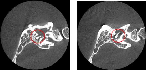 Slice images of the temporal bone from the micro CT scanner