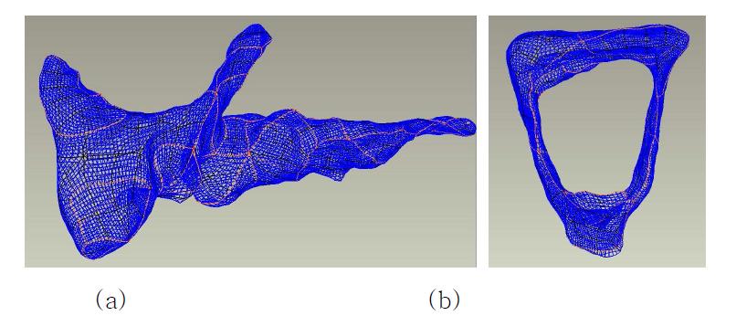 Wireframe model of the ossicles in 3D-Doctor software