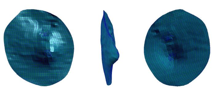 3D model of tympanic membrane