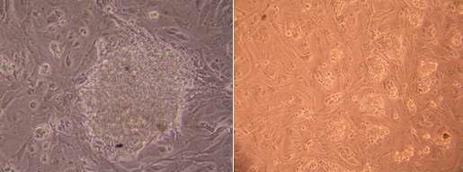 돼지 단위발생 배반포 유래 유사배아줄기세포의 모습