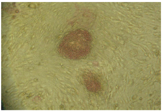 동정생식 배아줄기세포 유사세포의 Alkaline phosphatase 염색상