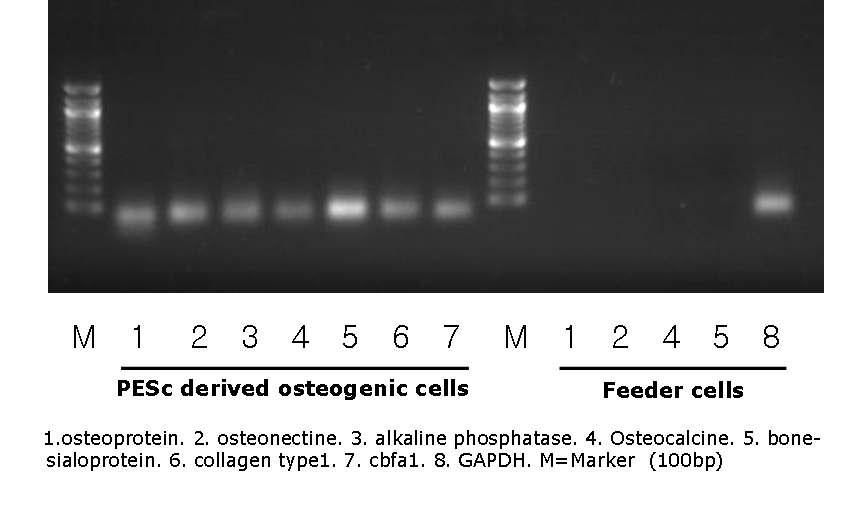 단위발생 배아줄기세포 유래 골형성세포의 유전자발현양상. 뼈세포특이유전자 (1, 2, 4, 5) 발현확인