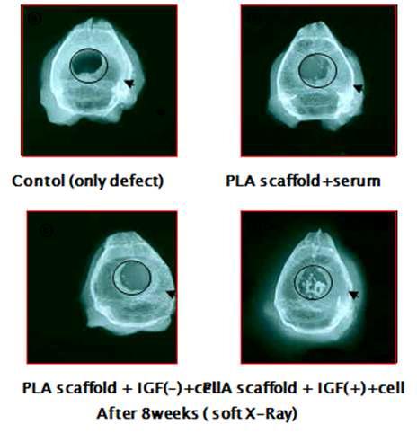 각각의 실험 그룹의 X-Ray 결과: 우측하단 의 IGF-2 처리 줄기세포 주입 그룹에서 강 한 골조직 형성 관찰.