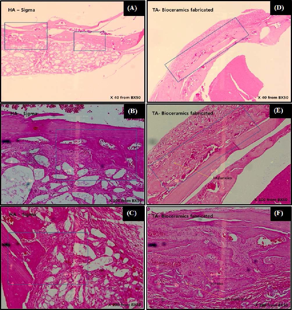 H&E staining of the HA control group (a-c) and tooth powders (d-f)after four weeks of in vivo transplantation