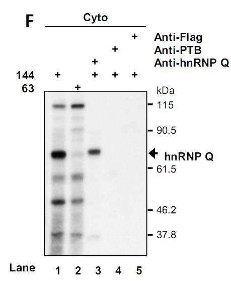 immunoprecipitation / UV cross-linking 실시. 그결과 68kD의 protein이 hnRNP Q라 판명됨. hnRNP Q가 IRES activity가 높은 5'UTR construct에는 잘 binding 하지만 IRES activity가 사라진 deletion construct에는 잘 binding 하지 못하는 것으로 예상 됨.