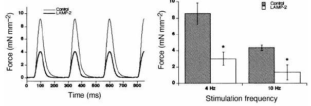 LAMP2의 결핍으로 인한 cardiomyopathy Ref.Nature 2000. Paul Saftig