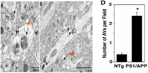 PS/APPAd mouse 뇌에서 autophagy 증가.