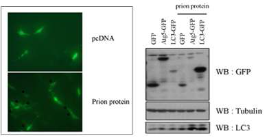 Proin protein에 의한 autophagosome 형성 및 LC3 I에서 LC3 II로의 conversion 유도 효과