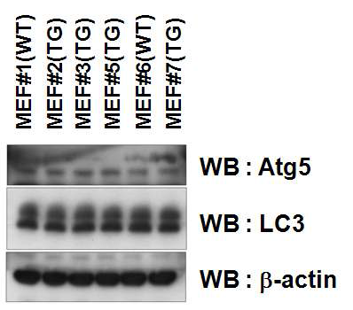 Primary cultured MEF에서 LC3 conversion 관찰