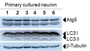 Primary cultured neurons에서 Atg5 및 LC3 conversion 관찰