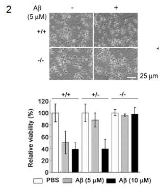 E2-25K/Hip-2 KO primary cortical neuron이 A β의 toxicity에 대한 저항성.