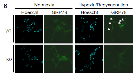 Hypoxia/reoxygenat에서 E2-25K/Hip-2 knockout neuron이 ER stress를 적게 받음.