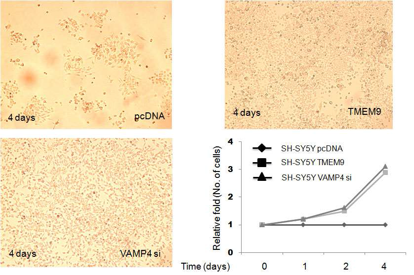 Cell growth에 미치는 영향분석. SH-SY5Y 세포에 각각 TMEM9, VAMP4 si유전자를 안정적으로발현시킨 후 시간별로 세포의 수 관찰.