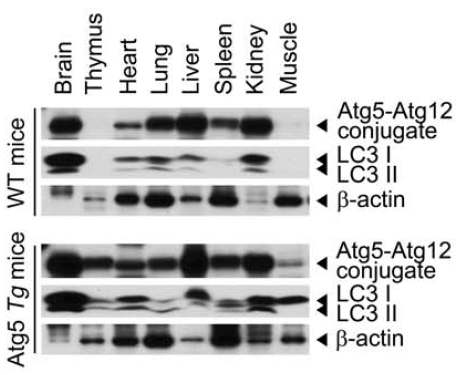 Atg5 Tg mouse tissue별 Atg5의 발현 분석