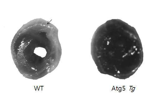 Atg5 Tg mice 심장의 ischemic damage에 대한 저항성 조사