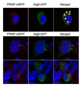 Conforcal 현미경“ 프리온과 Atg6의 colocalization