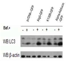 Alpha-Adducin 과발현으로 인한 LC3 II 증가