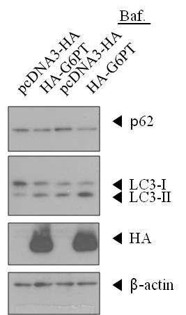 G6PT 과발현에 의한 LC3 II 증가