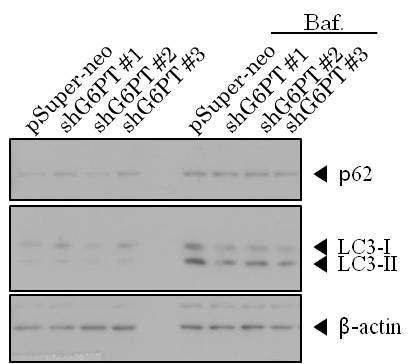 G6PT의 knock-down에 의한 LC3 II 감소