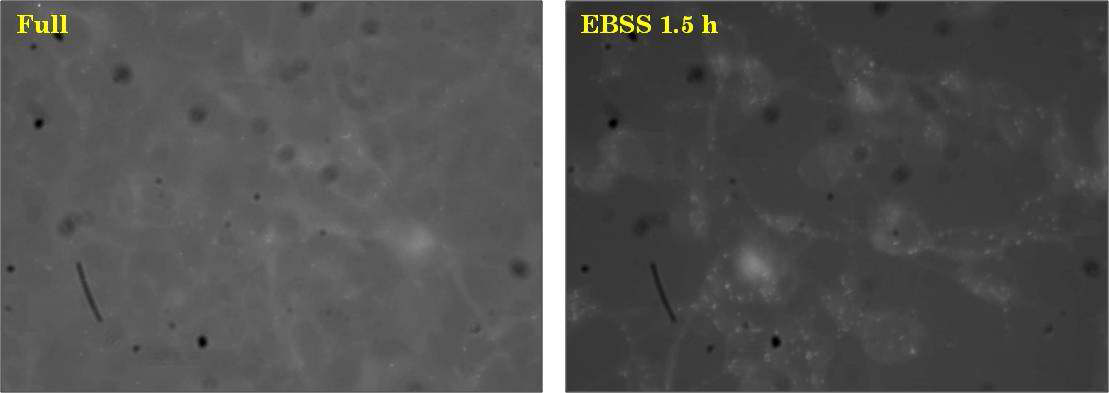 Screening assay를 위한 HEK293T/GFP-DFCP1 stable cell line