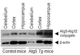 Atg5 Tg mice의 brain에서의 Atg5 발현 조사
