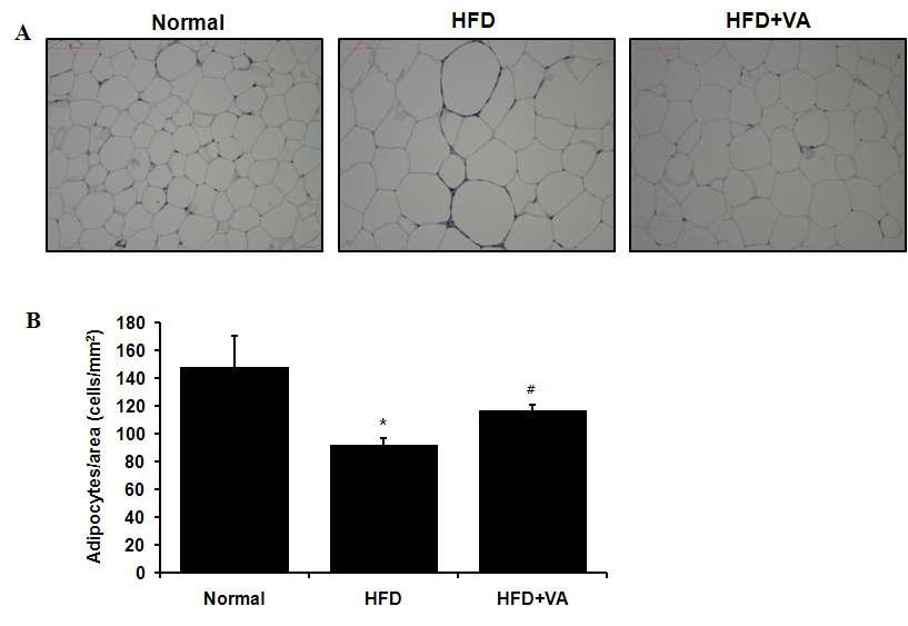Vitisin A에 의한 지방세포의 크기와 수의 변화(H&E 염색) (*, P<0.05)