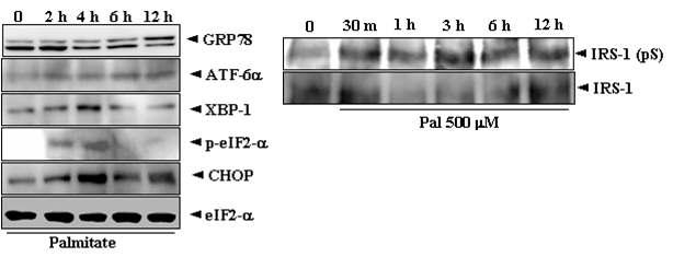 Palmitate에 의한 ER stress 단백질 발현과 IRS-1 인산화