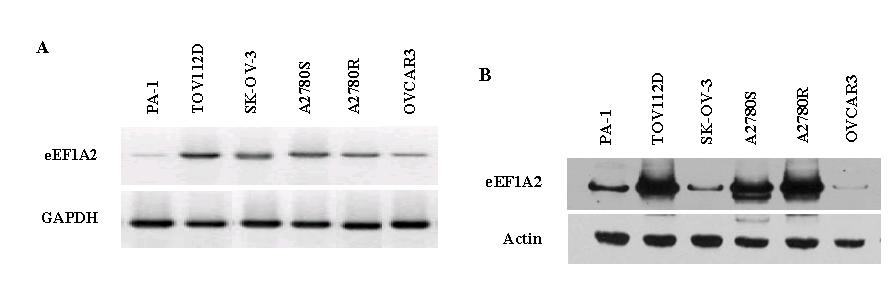난소암 세포주에서 eEF1A2 발현