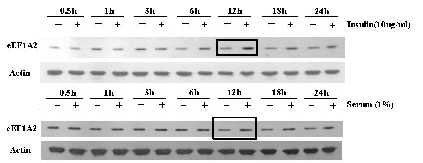 Insulin 또는 serum에 의해서 시간별로 유도되는 eEF1A2의 발현