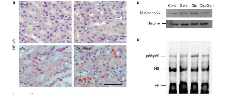 Genistein에 의한 cisplatin의 NF-kB 기전을 통한 억제효과
