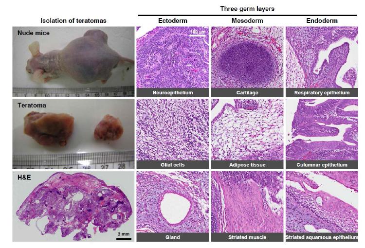 Cynomolgus 원숭이 배아줄기세포의 teratoma 형성능 검증.