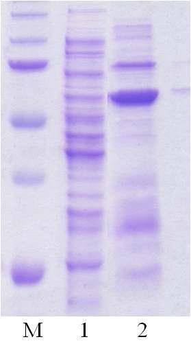 Overexpression of arabinofuranosidase in E. coli BL21 rosetta gami.