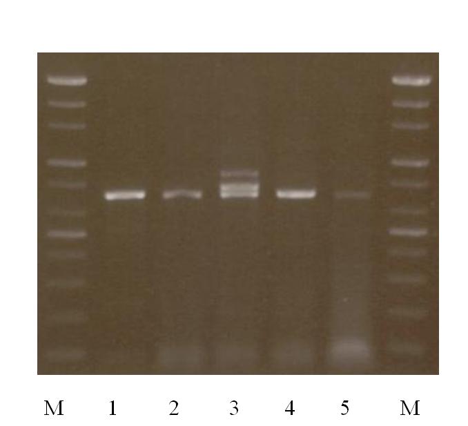 Gel electrophoresis of PCR products with degenerated primers for NR KS domain.