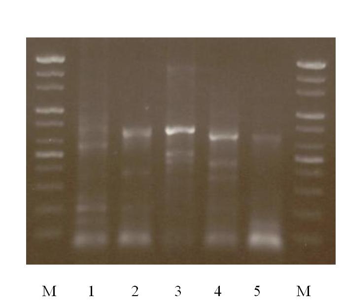 Gel electrophoresis of PCR products with degenerated primers for PR KS domain.