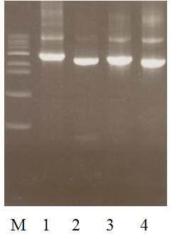 Gel electrophoresis of PCR products using primers for the exon of putative genes, β-glucosidase.