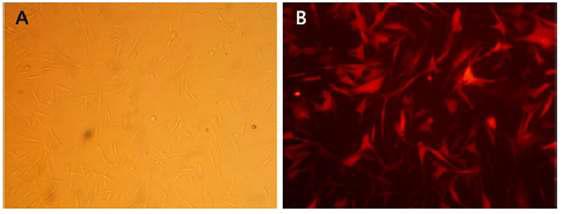 빨강형광복제개에서 유래한 지방간엽줄기세포의 형태.