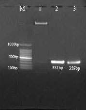 PCR analysis of transgenic cloned embryos