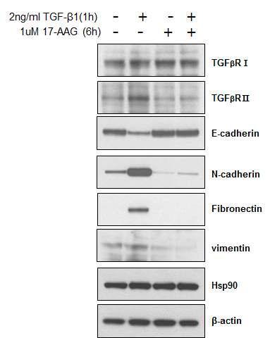 HSP90 inhibition by 17-AAG induces dgradation of TGF-βRII. HSP90 inhibition also regulates EMT-assoaciated proteins. TGF-β 1-induced down-regulation of E-cadherin and up-regulation of N-cadherin, fibronectin and vimentn were restored by 17-AAG in A549 cells