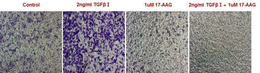 HSP90 inhibition by 17-AAG blocks cell invasion induced by TGF-β1 in A549 cells