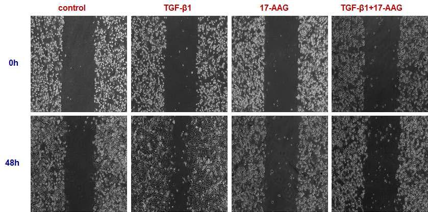 HSP90 inhibition by 17-AAG blocks cell motility induced by TGF-β1 in A549 cells