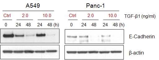 TGF-β1 induced the downregulation of E-cadherin expression n A549 and Panc-1 cells.