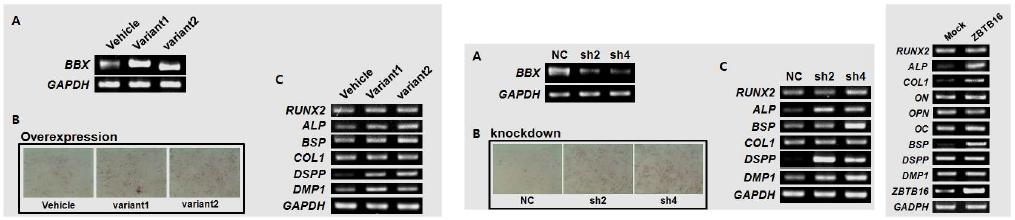 BBX 과발현과 넉다운 그리고 ZBTB16 과발현에 의한 상아모세포분화 양상