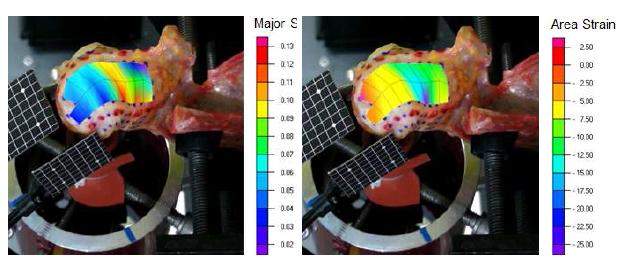 ASIAS-bio를 사용한 관절막 변형률 측정 결과