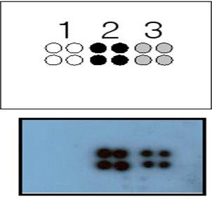 Figure 15. [γ-32P]ATP을 이용한 바이오칩 적용 유효성