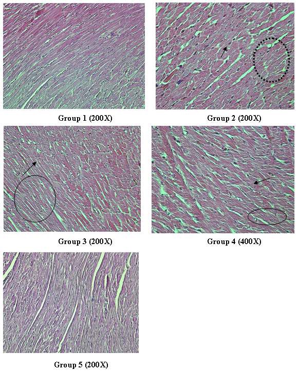 Fig. 40. Effect of hesperidin treatment on the histopathology of heart tissue of rats exposed to γ-radiation