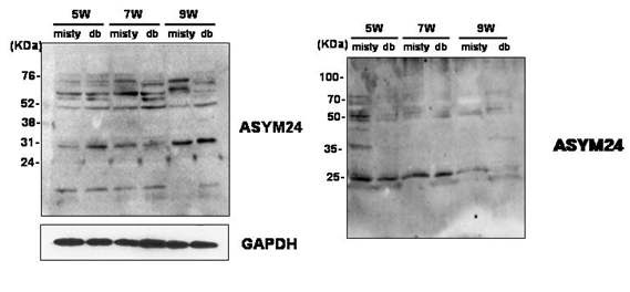 Fig. 46. Changes of arginine methylation during the period of diabetogenesis.